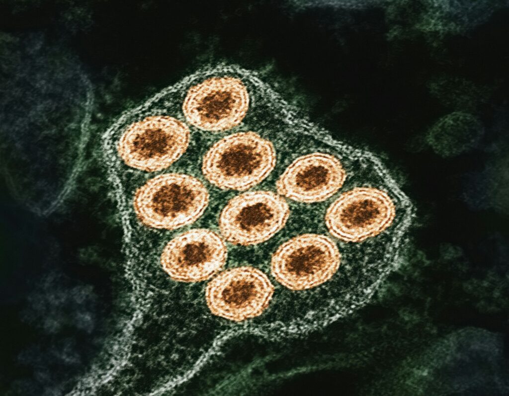 national-institute-of-allergy-and-infectious-diseases-QB0-6Mf7-CU-unsplash pulsewire