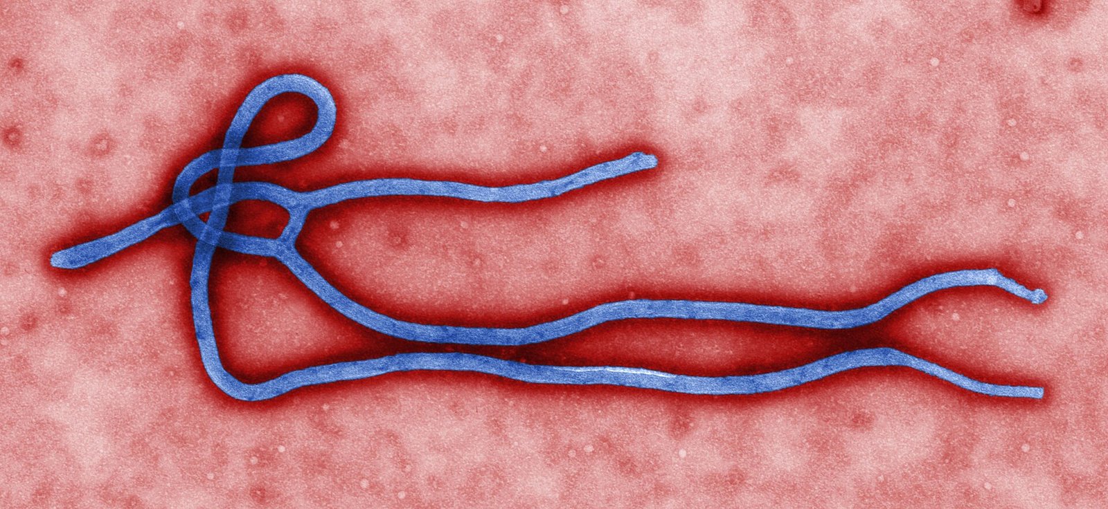 Nigeria’s Ebola patient is a Swiss diplomat’s wife; investigators probe possible link to Kenya’s first death